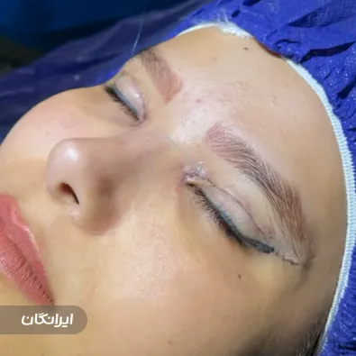 کلینیک جراحی پلک