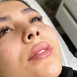 مرکز زیبایی و لیزر نورا