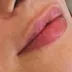 کلینیک زیبایی آناشید