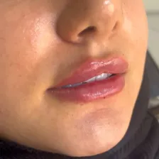 کلینیک زیبایی بیوتی آفیس