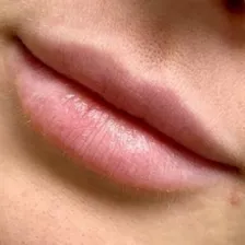 کلینیک زیبایی سینوهه