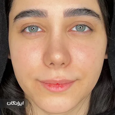کلینیک زیبایی دکتر افشین پورنصیر