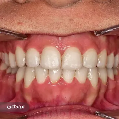 فتوگرافی پزشکی کارینو
