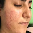 کلینیک زیبایی 100