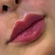 کلینیک زیبایی آرارز