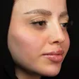 مجموعه پوست و لیزر ماه سیما