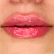 کلینیک زیبایی رویال