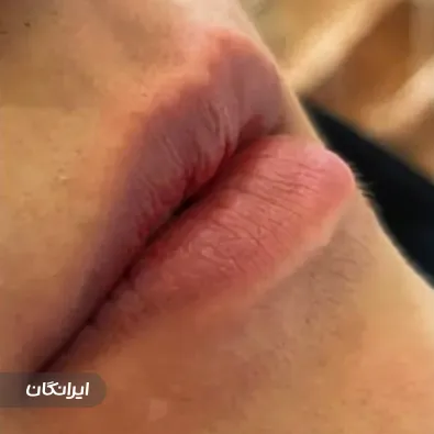 کلینیک زیبایی آتیماه