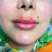 کلینیک زیبایی دکتر رضا قربانی قرا