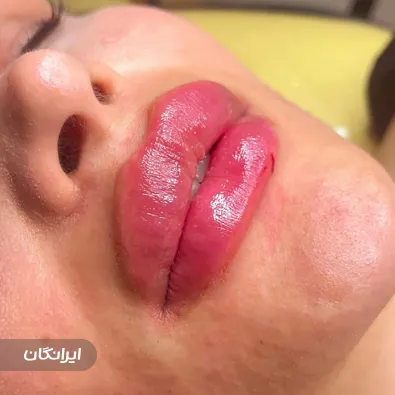 کلینیک زیبایی پر