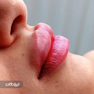 کلینیک زیبایی پر