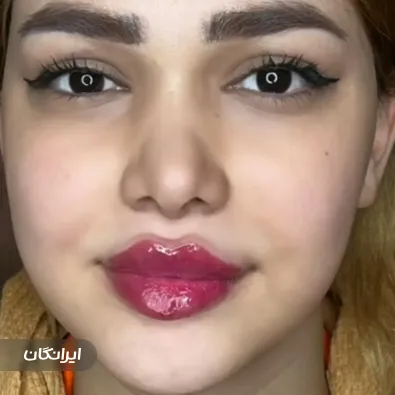 کلینیک زیبایی گلدن رویال