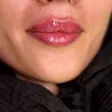 کلینیک زیبایی دکتر پیام بهرو