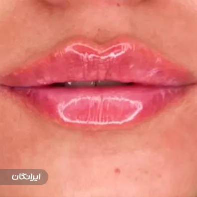 کلینیک زیبایی آویش