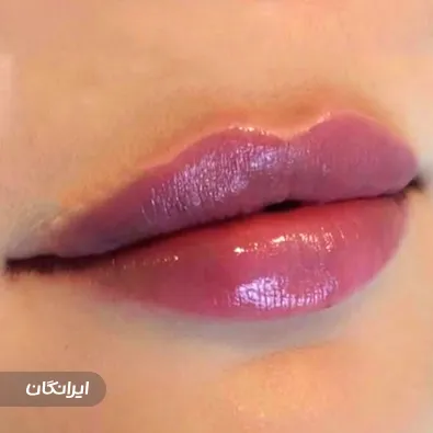 کلینیک زیبایی مهسیما