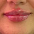 کلینیک زیبایی نیولایف