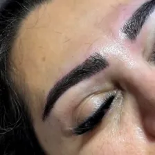 کلینیک کاشت مو بهار 