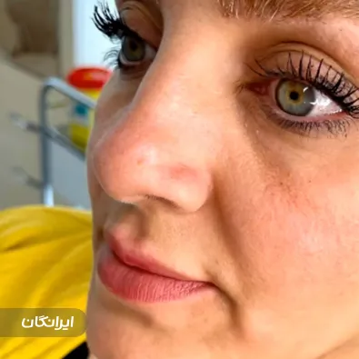 کلینیک زیبایی دکتر شیما بهارامید