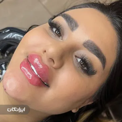 کلینیک زیبایی آویسا