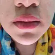 کلینیک زیبایی تینا
