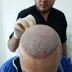 کارشناس کاشت مو مجید صبحی