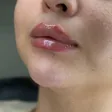 کلینیک زیبایی عسل