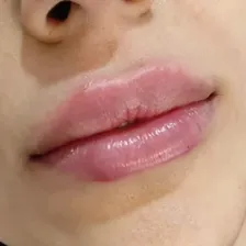 کلینیک زیبایی پریان