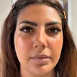 کلینیک زیبایی دکتر میلاد کبیری سامانی