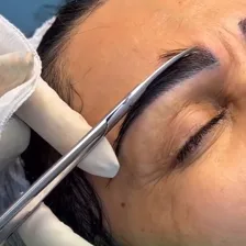 کارشناس کاشت مو شادی حسینی