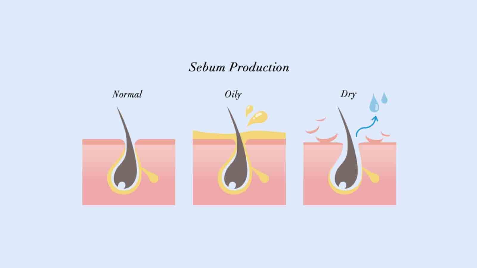رفع وزی و خشکی مو