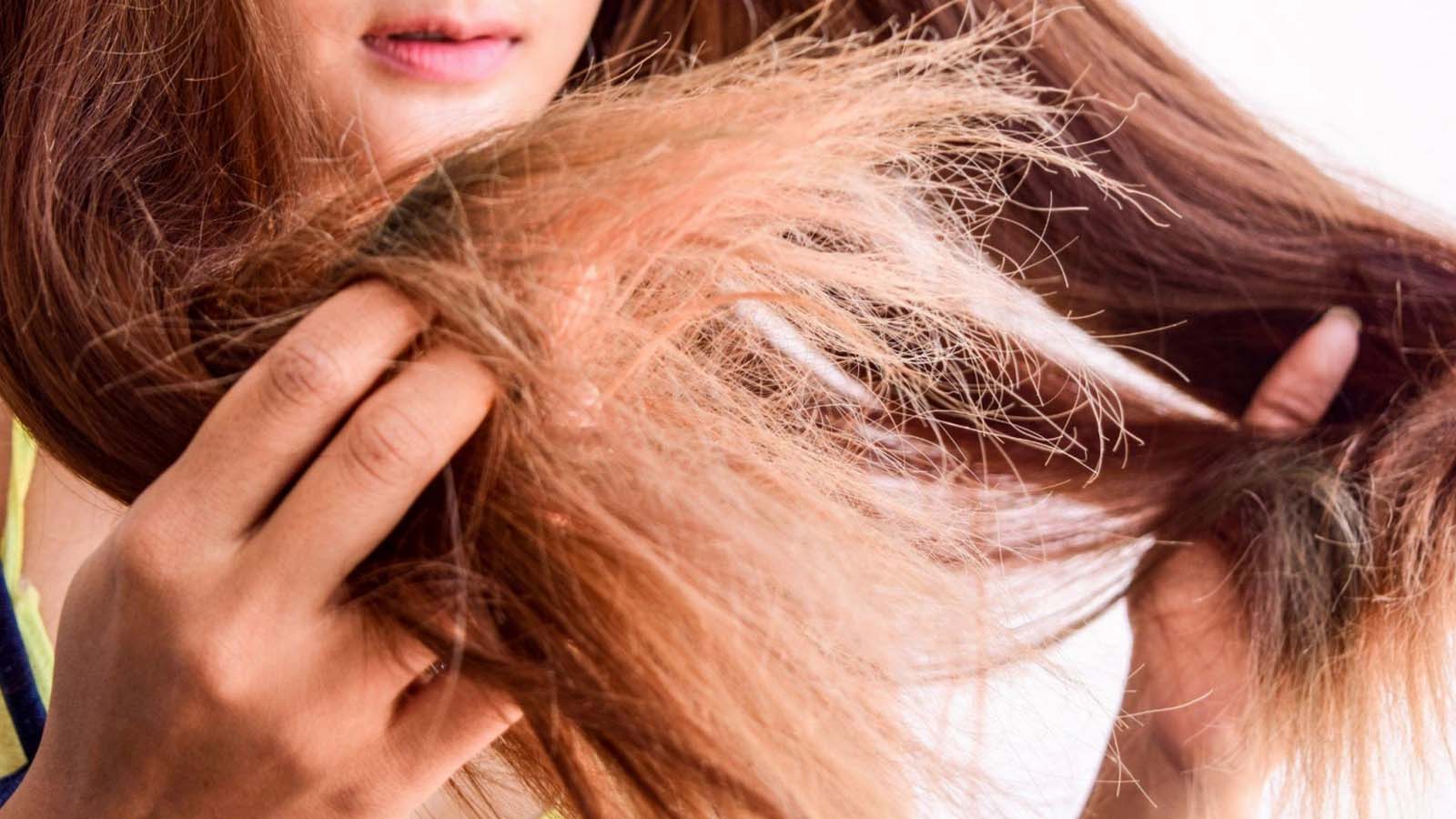 برای خشکی مو چه ویتامینی بخوریم