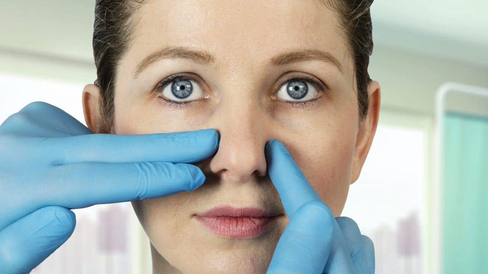 انحراف بینی چیست و چه علائمی دارد؟ فهرست مطالب انحراف بینی چیست و چه علائمی دارد؟ انحراف بینی یا (Septal Deviation ) یکی از شایعترین مشکلات بینی است. در این عارضه تیغه میانی بینی (سپتوم) که دو حفرهی بینی را از یکدیگر جدا میکند، در مرکز قرار ندارد و به یک سمت متمایل شده و انحراف پیدا میکند. این انحراف میتواند مادرزادی باشد یا در اثر ضربه، شکستگی یا عمل جراحی رخ دهد. اگرچه درجاتی از انحراف بینی در بسیاری از افراد وجود دارد، اما گاهی این مشکل بهقدری شدید میشود که بر کیفیت زندگی، تنفس، خواب و حتی سلامت کلی بدن تأثیر میگذارد و منجر به علائمی نظیر سردرد، کاهش حس بویایی و انسداد تنفسی و خشکی گلو، خونریزی بینی و… میشود. تشخیص این عارضه عموما با معاینهی بالینی بینی یا تصویربرداری رادیوگرافی، توسط پزشک متخصص راینولوژی صورت میگیرد. راینولوژی یک شاخهی فوق تخصصی از رشته گوش و حلق و بینی و جراحی سر و گردن است و به بیماریها و جراحیهای ناحیه بینی میپردازد. اکنون با نگاهی جامع، به بیماری انحراف بینی، علائم و روشهای تشخیص و درمان آن میپردازیم و ارتباط آن با اختلالات گوش، مشکلات ریوی، سینوزیت، خواب و زیبایی را بررسی میکنیم. از کجا بفهمیم انحراف بینی داریم؟