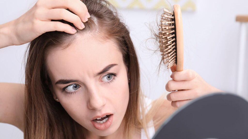 ریزش مو ارثی چیست؟