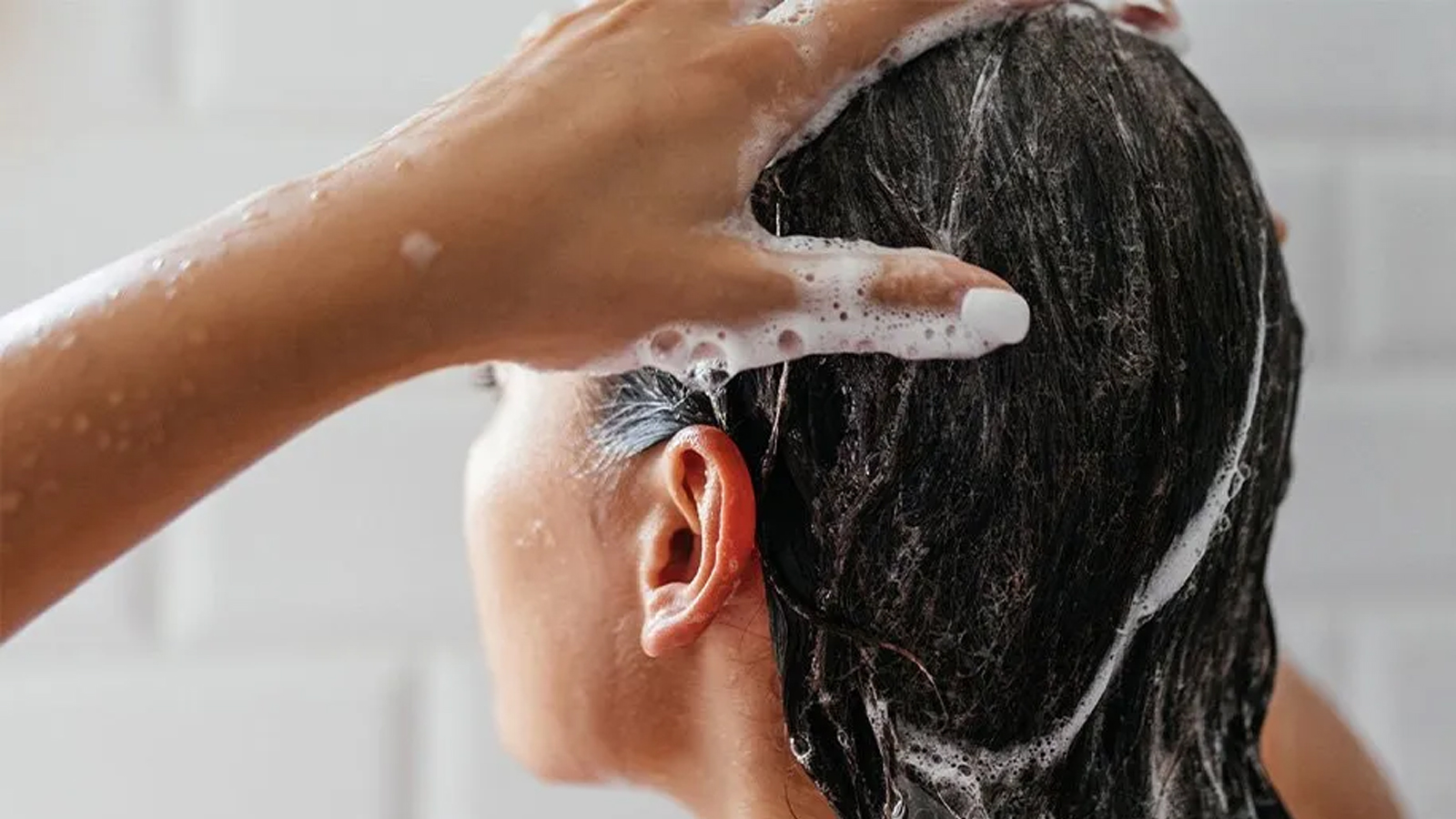 شامپو کتوکونازول