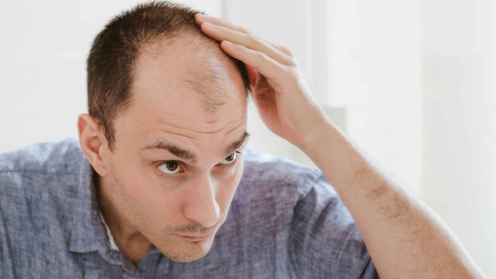 تفاوت ر‌یز‌ش‌ مو‌ ا‌ر‌ثی و هورمونی