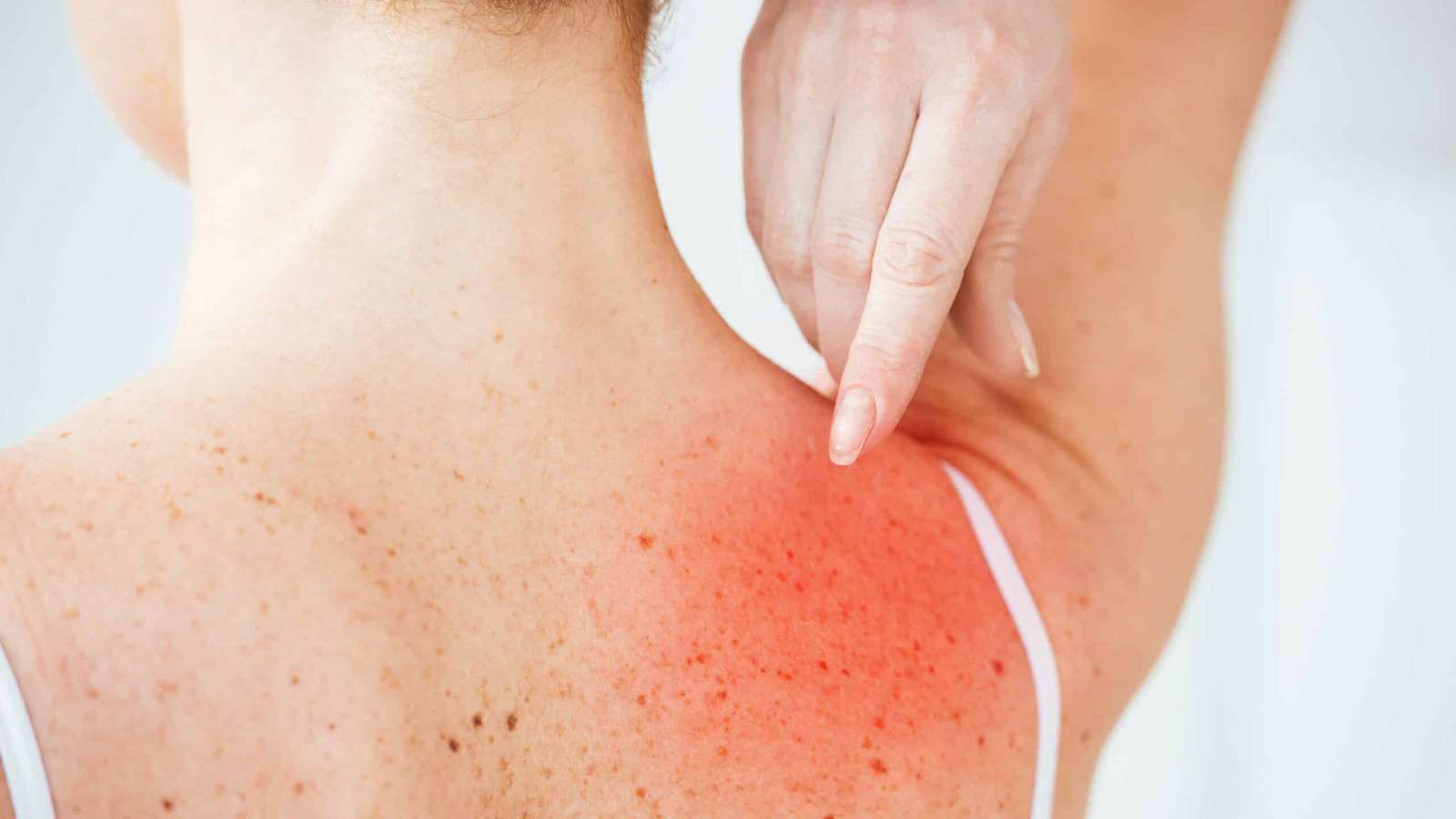 عرق سوز چیست؟