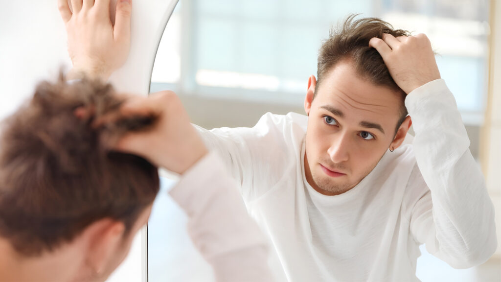 ریزش مو بعد از کاشت