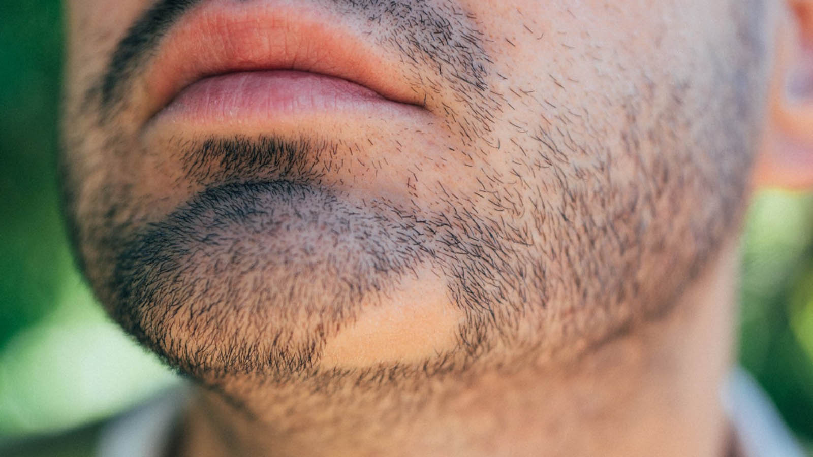 تزریق کورتون برای ریزش مو