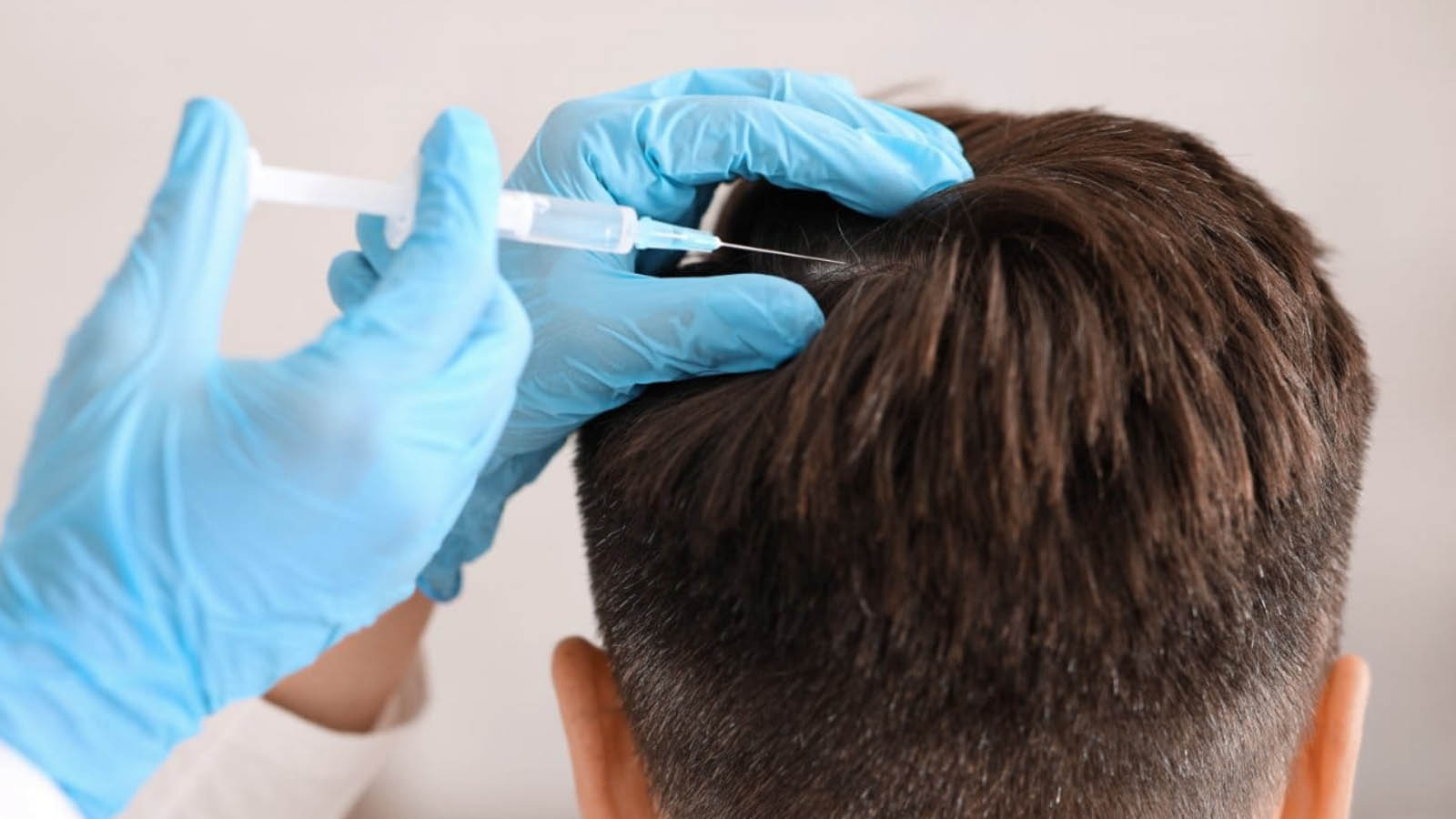 آیا ریزش مو سکهای برگشت دارد