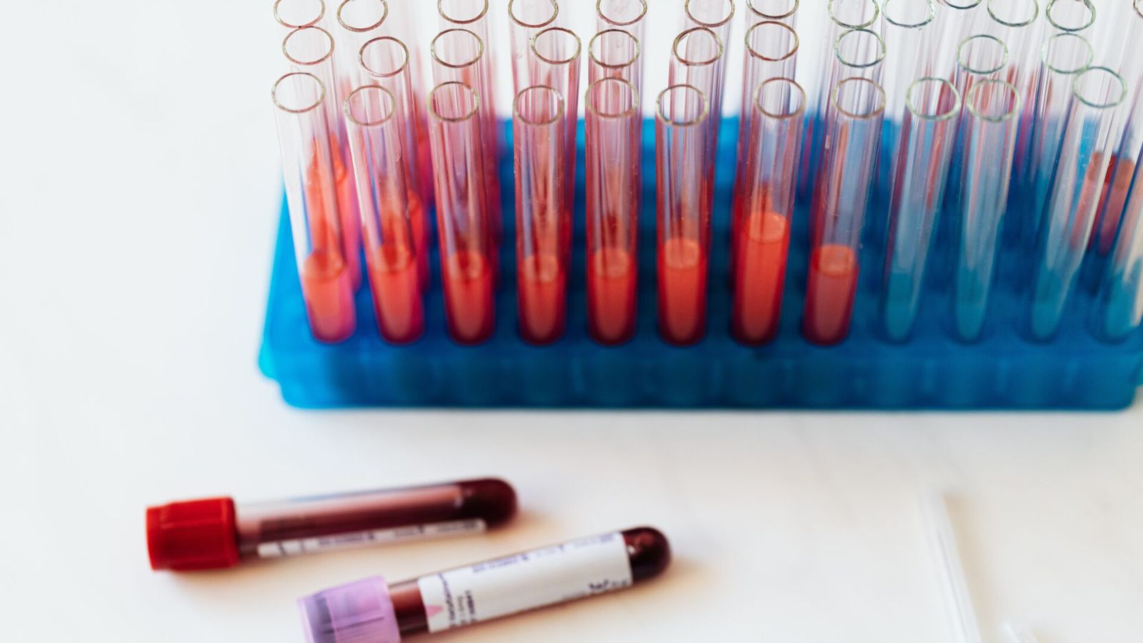 آزمایش بیوتین و نتایج کاذب