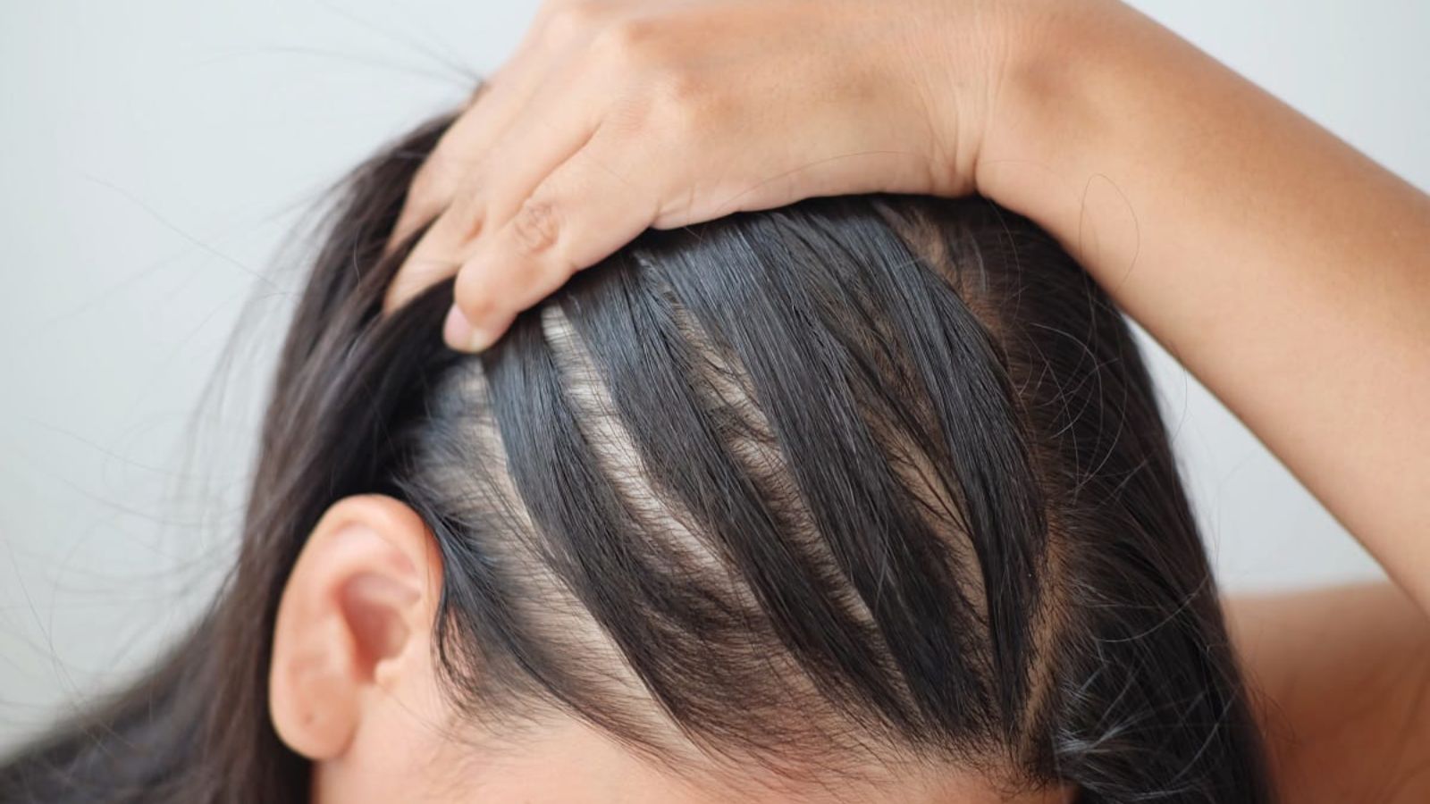 بیوتین برای رشد مو