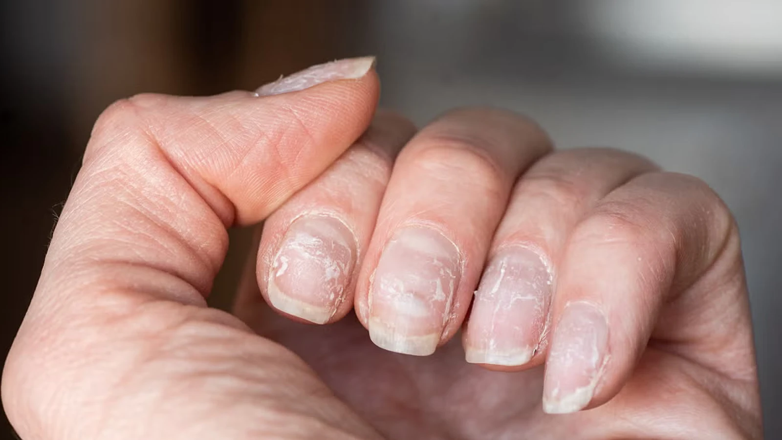 Side effects of gel nails for teenagers
