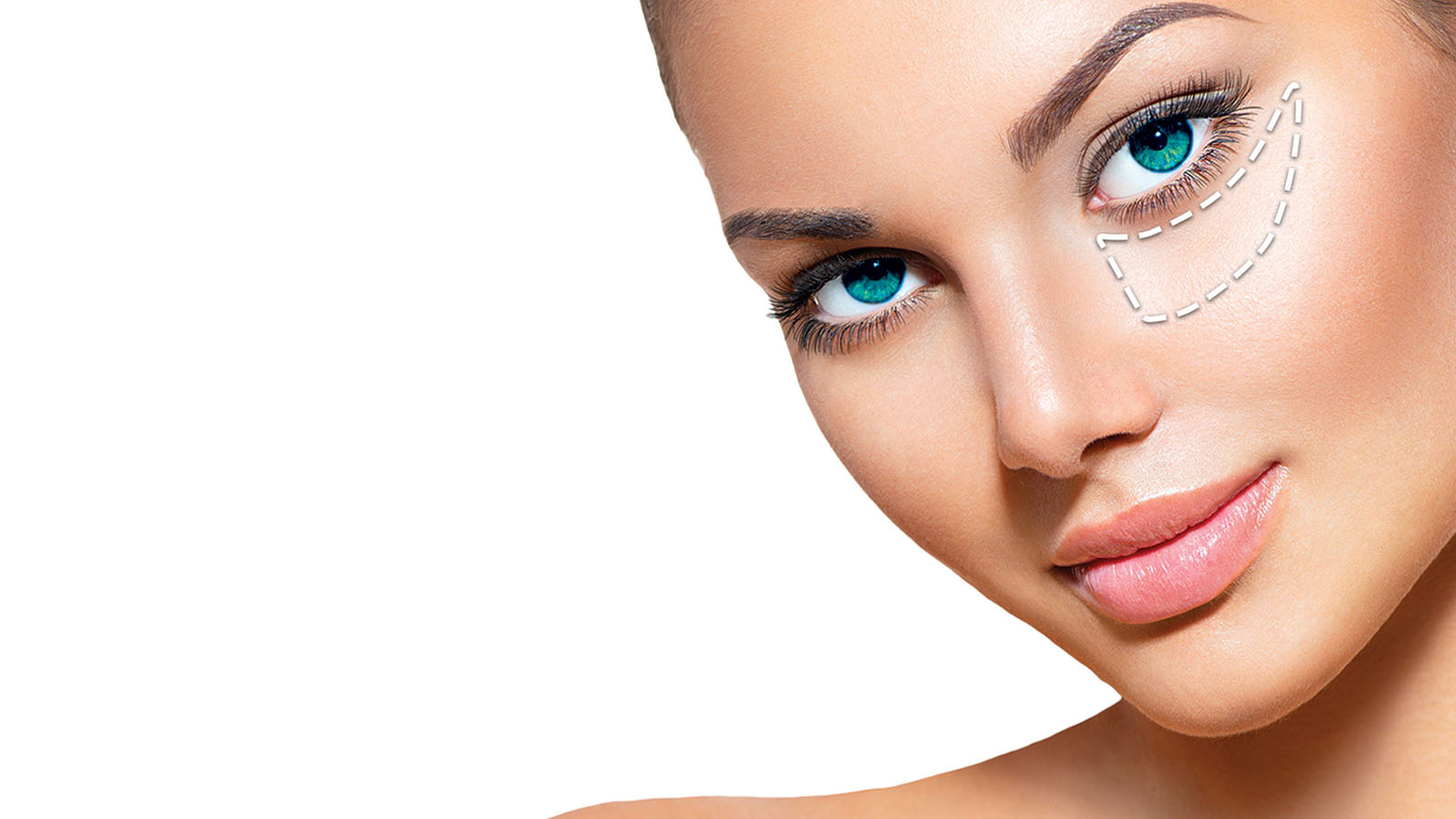 فیلر زیر چشم ضرر دارد