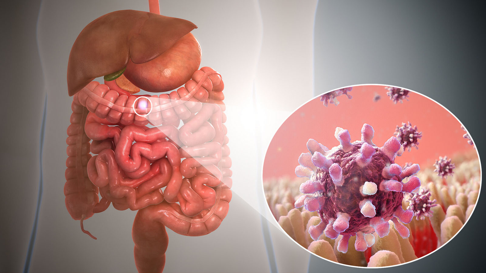 محلول نمکی خانگی برای اسهال