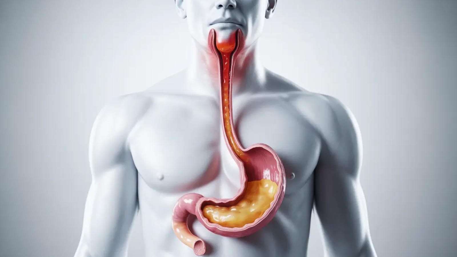 چای بابونه برای سوزش معده