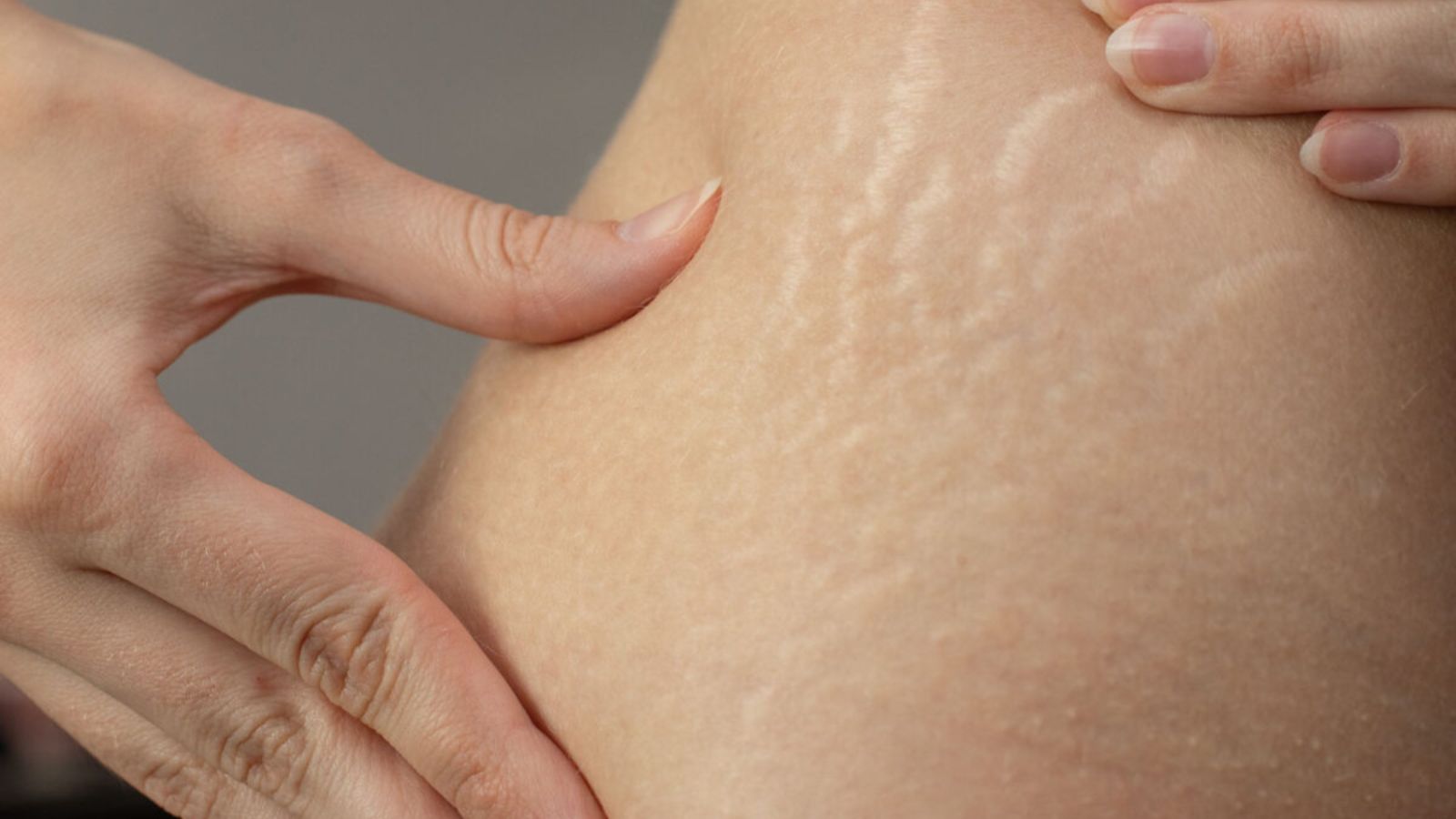 ترکهای بالغ که استریا آلبا