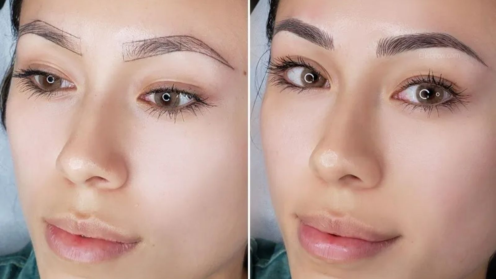 هزینه فیبروز و میکرو