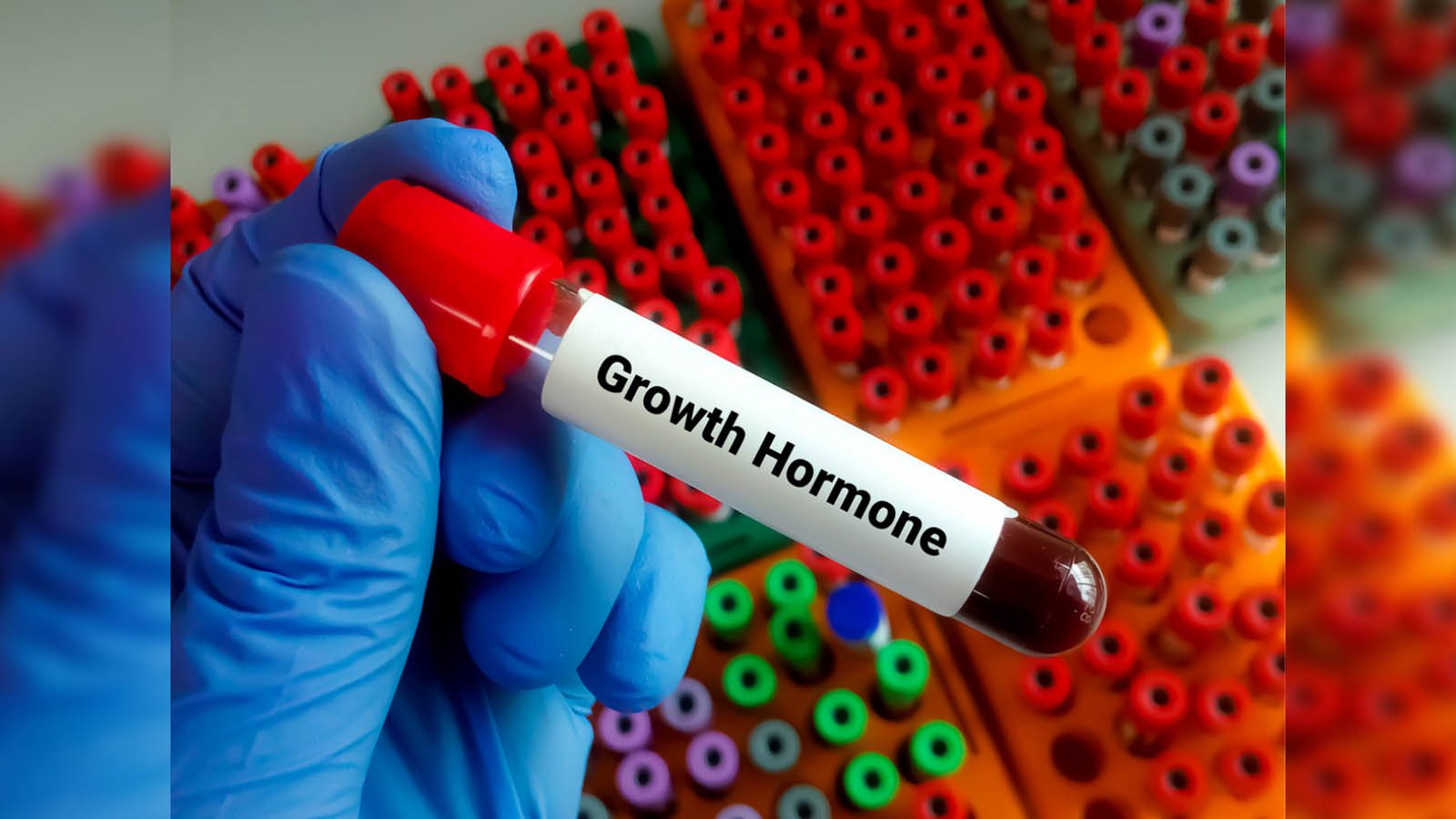 قیمت آمپول هورمون رشد در داروخانه