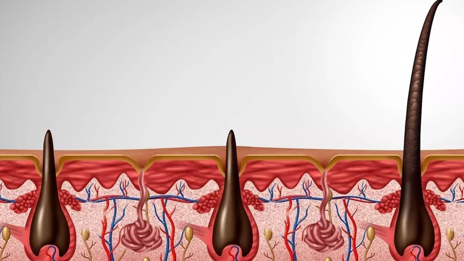 اختلالات فولیکول مو