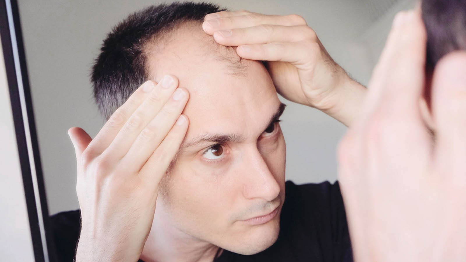 تقویت فولیکولهای ضعیف